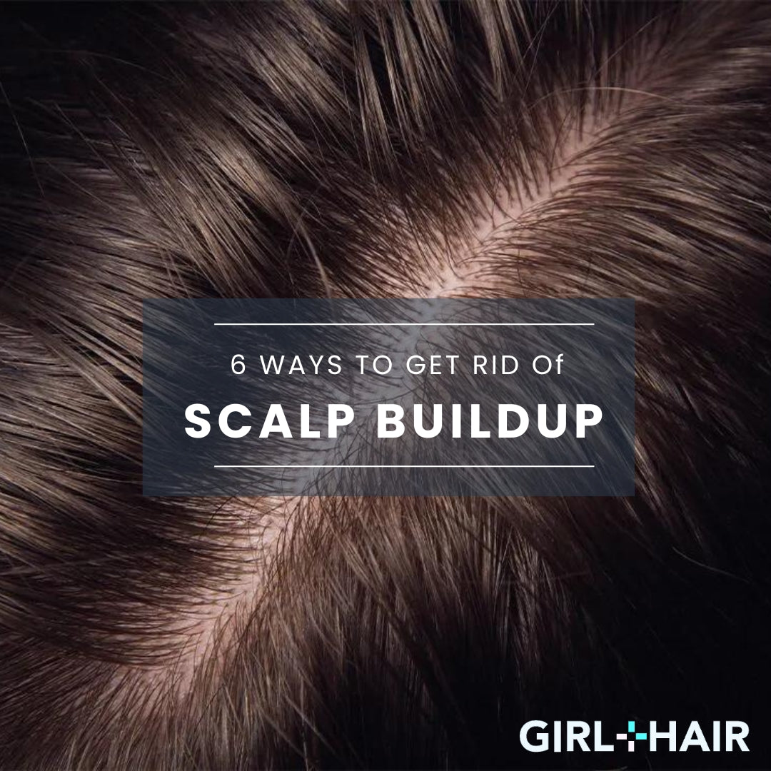 6 Ways to Get Rid of Scalp Buildup